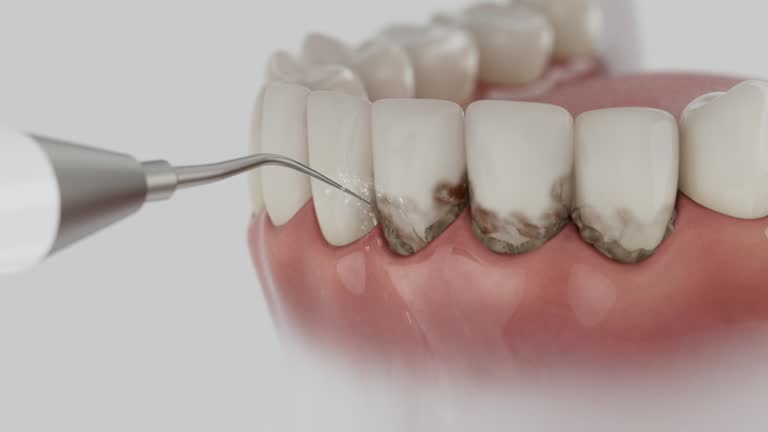 Reliable Dental Implants contractor in Piedmont, MO by Smile Center Dentistry
